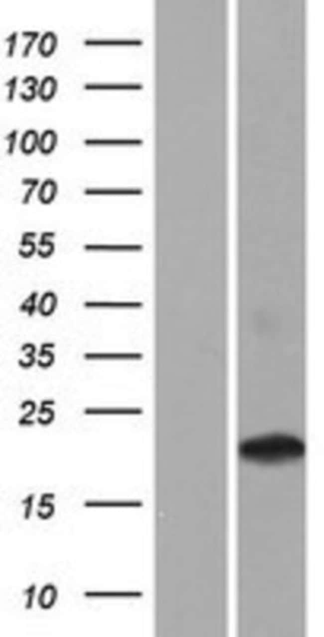 Novus Biologicals CD300d Overexpression Lysate, Quantity
