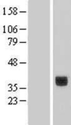 Novus Biologicals&trade;&nbsp;CLEC10A/CD301 Overexpression Lysate