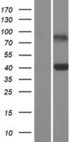 Novus Biologicals™ CLEC10A/CD301 Overexpression Lysate