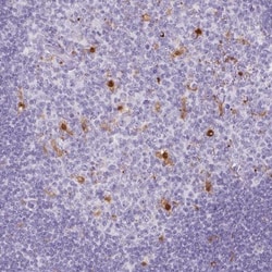 CD30/TNFRSF8 Antibody, Novus Biologicals 0.1mL; Unlabeled:Antibodies, Polyclonal