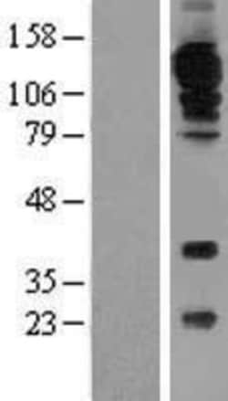 Novus Biologicals&trade;&nbsp;CD31/PECAM-1 Overexpression Lysate