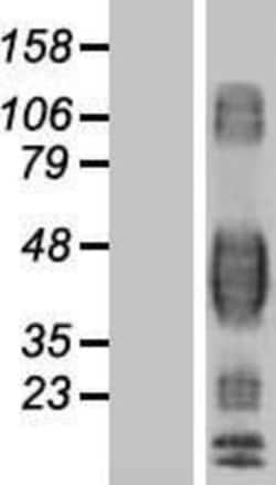 Novus Biologicals&trade;&nbsp;Fc gamma RII/CD32 Overexpression Lysate