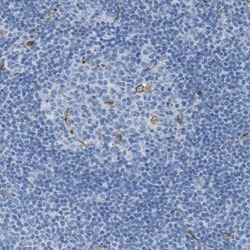 CD320/TCblR/8D6A Antibody, Novus Biologicals 0.1mL; Unlabeled:Antibodies,