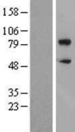 Novus Biologicals&trade;&nbsp;CD36 Overexpression Lysate