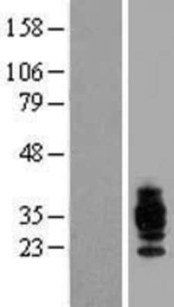 Novus Biologicals&trade;&nbsp;CD37 Overexpression Lysate