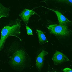 CD39/ENTPD1 Antibody, Novus Biologicals 25 &mu;L; Unlabeled:Antibodies,