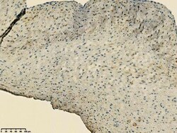 CD39/ENTPD1 Antibody, Novus Biologicals 25 &mu;L; Unlabeled:Antibodies,