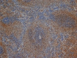 CD3 delta Antibody (1F4), Novus Biologicals 0.025 mg | Buy Online | Novus Biologicals | Fisher Scientific
