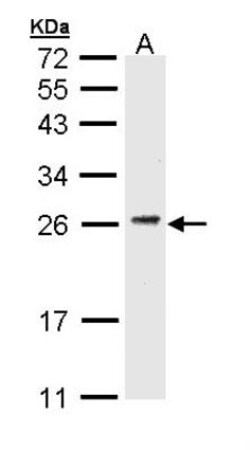 CD3 gamma Antibody, Novus Biologicals 0.1mg; Unlabeled:Antibodies, Polyclonal