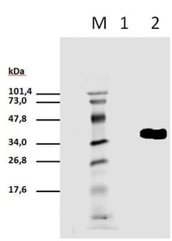 CD3 zeta, p Tyr111 Antibody (EM-55) - BSA Free, Novus Biologicals 0.1mg;