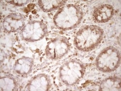 CD40/TNFRSF5 Antibody (OTI8B8), Novus Biologicals 0.1mL; Unlabeled:Antibodies,