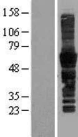 Novus Biologicals&trade;&nbsp;CD43/Sialophorin Overexpression Lysate