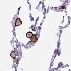 CD43/Sialophorin Antibody, Novus Biologicals:Antibodies:Primary Antibodies