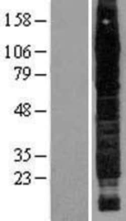 Novus Biologicals™ CD44 Overexpression Lysate