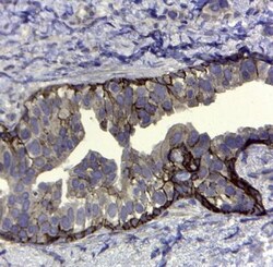 CD44 Antibody (VFF-8) - variant 5, Novus Biologicals:Antibodies:Primary
