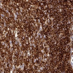 CD45 Antibody (CL0160), Novus Biologicals 25ul | Buy Online | Novus Biologicals | Fisher Scientific