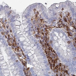 CD45 Antibody (CL0160), Novus Biologicals 25ul | Buy Online | Novus Biologicals | Fisher Scientific