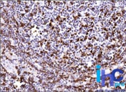 CD45RO Antibody (UCHL-1), Novus Biologicals 0.1mg; Unlabeled:Antikörper
