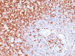 CD45RO Antibody (UCHL-1), Novus Biologicals 0.1mg; Unlabeled:Antikörper