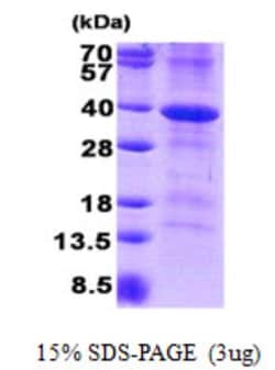 Novus Biologicals Recombinant Human CD46 His Protein 0.1 mg | Buy Online | Novus Biologicals&trade; | Fisher Scientific
