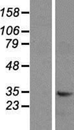 Novus Biologicals&trade;&nbsp;CD47 Overexpression Lysate