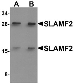 CD48/SLAMF2 Antibody - BSA Free, Novus Biologicals 0.1mg; Unlabeled:Antibodies,