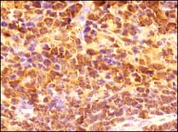 CD4 Antibody - BSA Free, Novus Biologicals 0.025mL; Unlabeled:Antibodies,