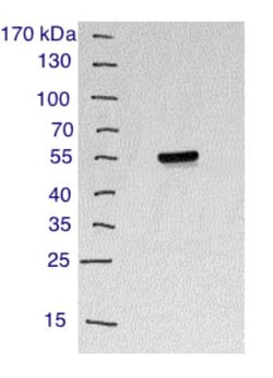 CD4 Antibody - BSA Free, Novus Biologicals 0.025mL; Unlabeled:Antibodies,