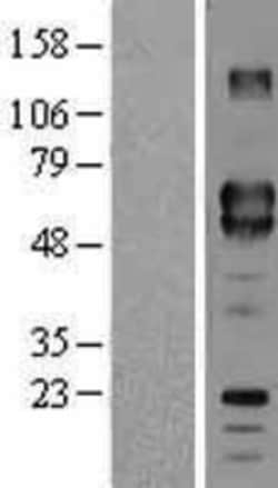 Novus Biologicals&trade;&nbsp;CD5 Overexpression Lysate