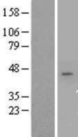 Novus Biologicals&trade;&nbsp;CD55/DAF Overexpression Lysate