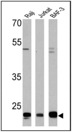 CD58/LFA-3 Antibody (TS2/9) - Azide and BSA Free, Novus Biologicals:Antibodies:Primary