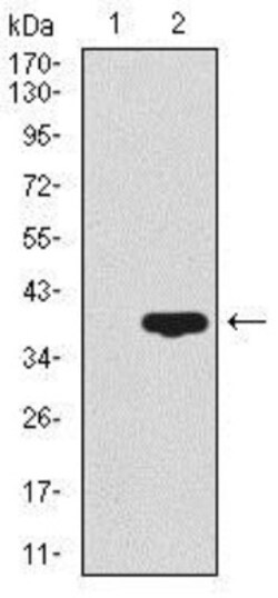 CD59 Antibody (8D2B8) - BSA Free, Novus Biologicals 0.1mL; Unlabeled:Antibodies,