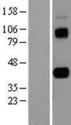 Novus Biologicals™ CD5L Overexpression Lysate