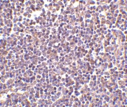 CD5L Antibody - BSA Free, Novus Biologicals 0.1mg; Unlabeled:Antibodies
