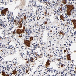 P-Selectin/CD62P Antibody, Novus Biologicals 0.1mL; Unlabeled:Antibodies,