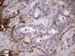 CD63 Antibody (OTI5E5), Novus Biologicals 0.1mL; Unlabeled:Antibodies,
