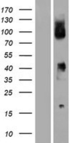 Novus Biologicals&trade;&nbsp;CD64/FCGR1B Overexpression Lysate
