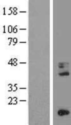 Novus Biologicals&trade;&nbsp;CD68/SR-D1 Overexpression Lysate
