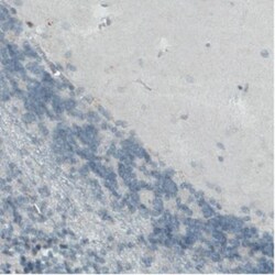 CD68/SR-D1 Antibody (CL1338), Novus Biologicals 25 &mu;L | Buy Online | Novus Biologicals | Fisher Scientific