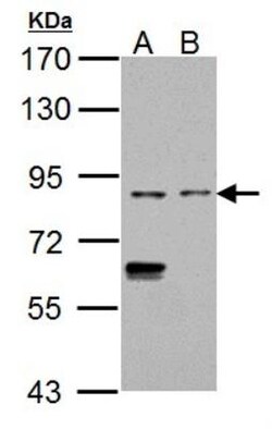 CD68/SR-D1 Antibody, Novus Biologicals 0.1mL; Unlabeled:Antibodies, Polyclonal