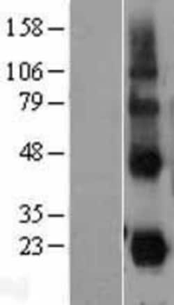 Novus Biologicals™ CD27 Ligand/TNFSF7/CD70 Overexpression Lysate