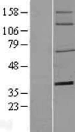 Novus Biologicals&trade;&nbsp;5'-Nucleotidase/CD73 Overexpression Lysate