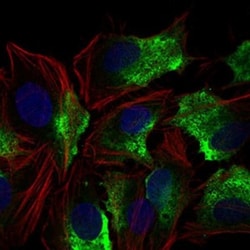 CD74 Antibody (2D1B3) - BSA Free, Novus Biologicals:Antibodies:Primary