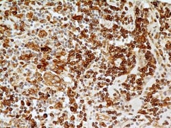CD74 Antibody (PIN.1) - BSA Free, Novus Biologicals 0.1mg; Unlabeled:Antibodies