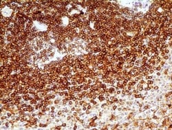 CD74 Antibody (PIN.1) - BSA Free, Novus Biologicals 0.1mg; Unlabeled:Antibodies