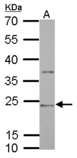 CD74 Antibody, Novus Biologicals 0.1mL; Unlabeled:Antibodies, Polyclonal