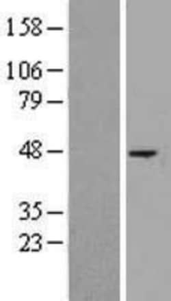 Novus Biologicals&trade;&nbsp;ST6 Gal Sialyltransferase 1/ST6GAL1/CD75 Overexpression Lysate