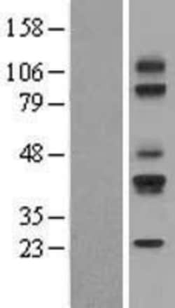 Novus Biologicals&trade;&nbsp;CD79A Overexpression Lysate