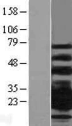 Novus Biologicals&trade;&nbsp;CD79B Overexpression Lysate