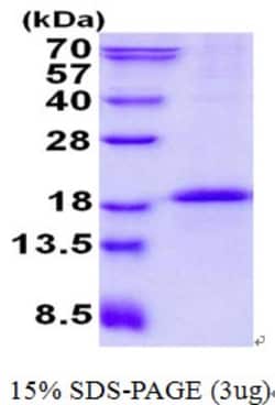 Novus Biologicals&trade;&nbsp;Recombinant Human CD79B His Protein